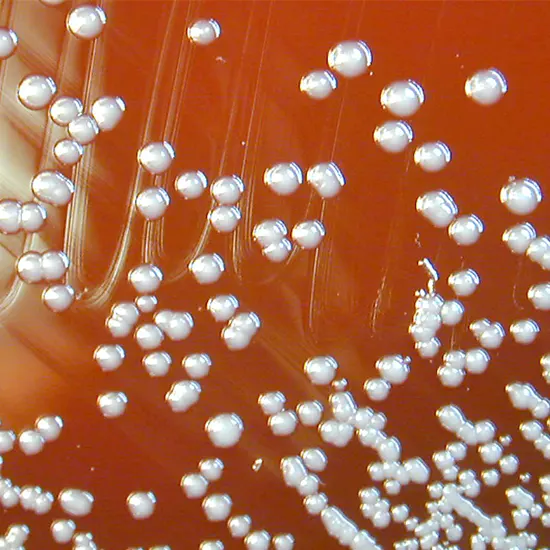 Burkholderia Infection